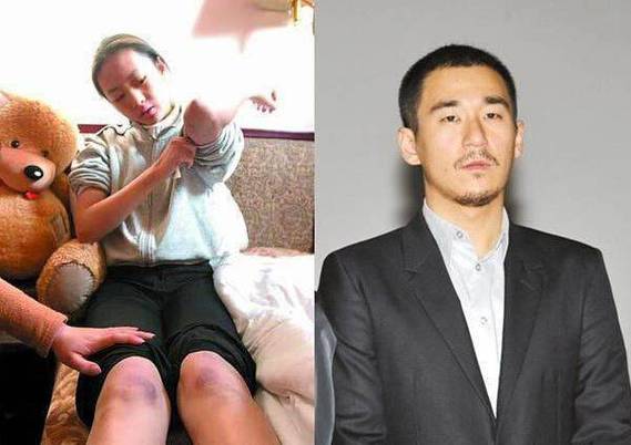 此次家暴事件的爆发，源于一次激烈的争执，据王瑞儿描述，男友在愤怒之下对她进行了疯狂的殴打，导致她右眼红肿不堪、嘴角流血、膝盖淤青，而最让她难以接受的是，她那价值百万的整容假胸也险些被打爆，照片中，王瑞儿虽然妆容精致，但脸上的伤痕和眼中的恐惧却难以掩饰，她声称，这次的家暴是她无法再忍受的底线，因此决定与男友彻底决裂。