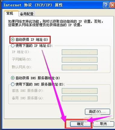 通过遵循上述建议和解答,相信你能够有效地应对“电脑本地连接不见了”的困扰,恢复正常的网络连接体验。