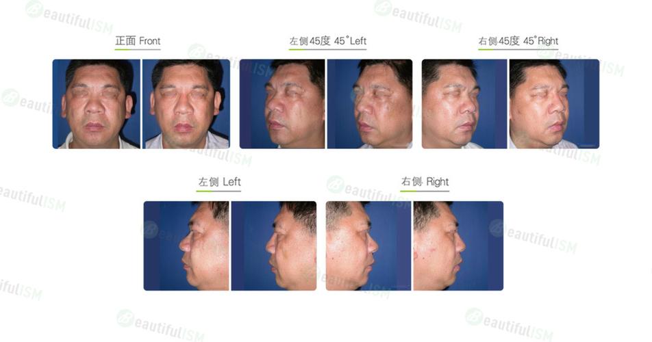- 仔细评估每个修复步骤的影响,确保其与原始照片的整体风格保持一致。
