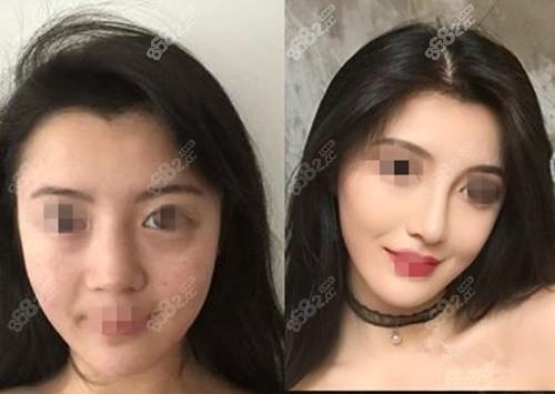 综合对比:哪个更好?