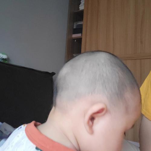 秃头小宝贝:自嘲中带着可爱,谁说秃头不迷人?